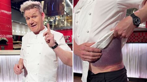 gordon ramsay bike accident details.